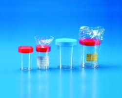 Contenitore URINA  200 ml, tappo a vite