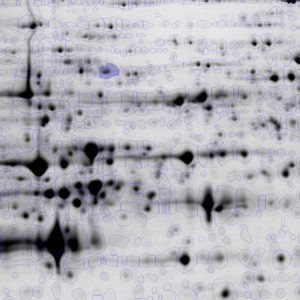 Professional 2D Gel Analysis Software